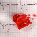 Heart failure on the rise