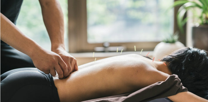 Acupuncture natural therapies reforms