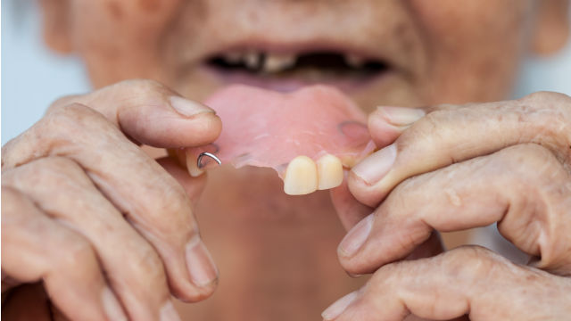 The list of 5 root canal costs without insurance 1 how much is root canal without insurance
