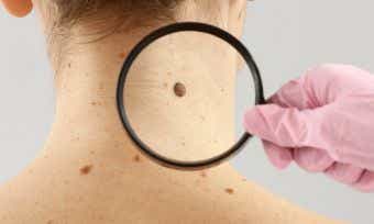 How common is skin cancer in Australia?