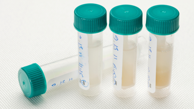 saliva sample containers